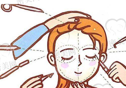 刘振兴医生擅长项目：