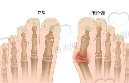 潘炯波医生口碑怎么样？