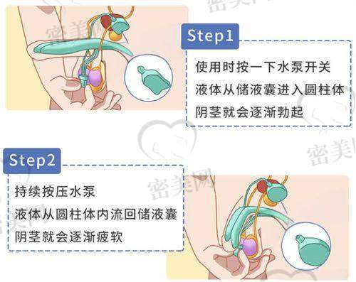菲林普利不同型号区别