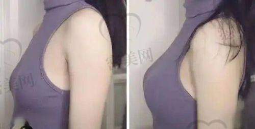 总结与心动邀请