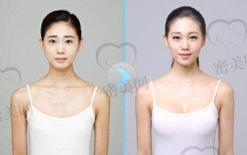 沈阳沈河创美医疗美容诊所 - 张旭医生