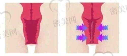 周福田医生口碑怎么样？