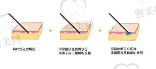 张传香医生怎么预约挂号？