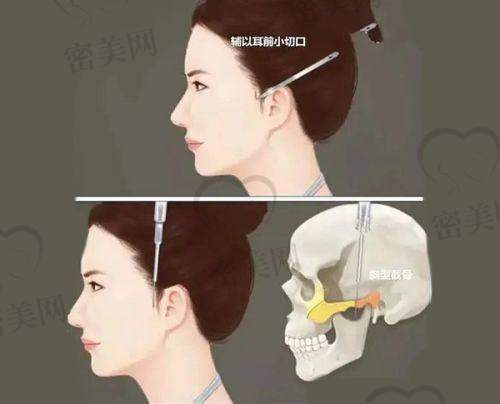 刘振兴医生怎么预约挂号？