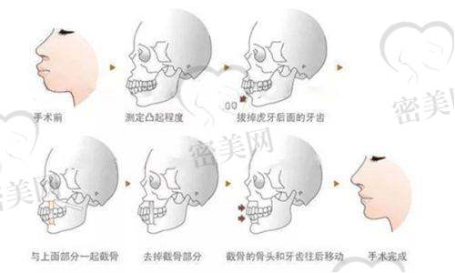 潘炯波医生技术特点