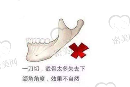 张传香医生口碑怎么样？