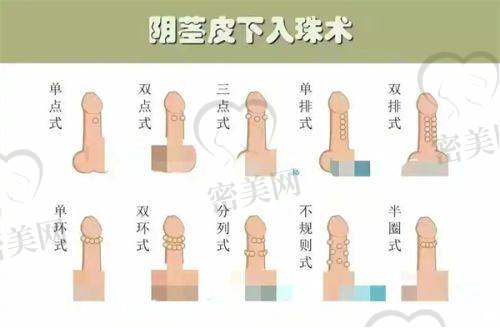 医美问答及攻略