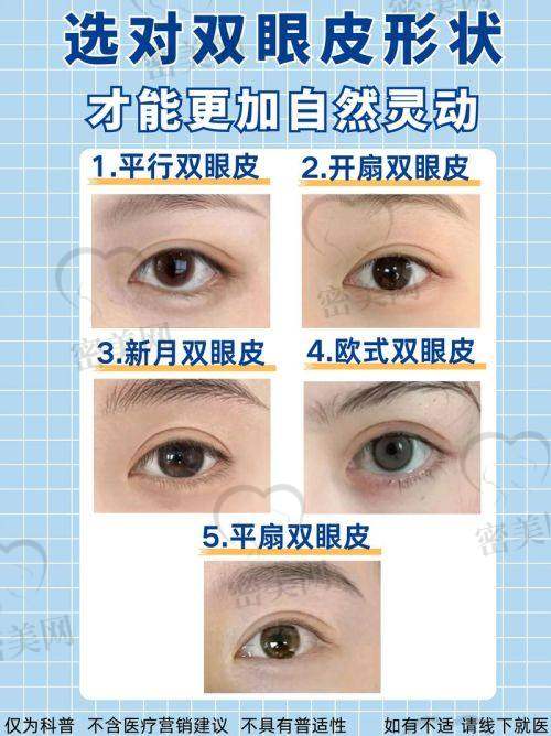 真人实例：北京华韩谢立宁双眼皮的“变得更美奇迹”
