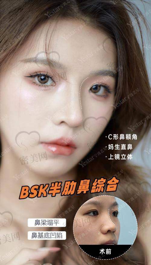 专精能力：上海李健医生的“看家本领”