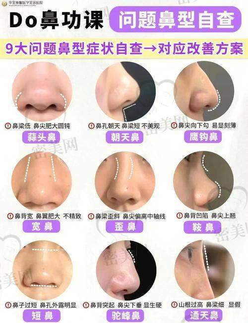 口碑：上海李健医生的“江湖传说”