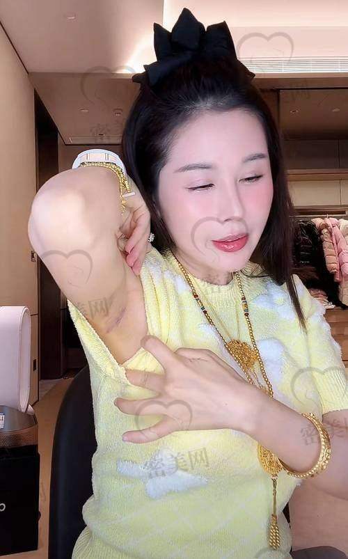 谢卫国医生隆胸排第几名的“江湖传说”
