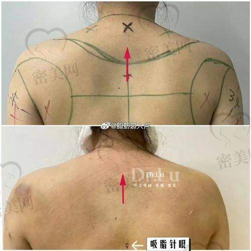 自信露背，开启夏日新体验