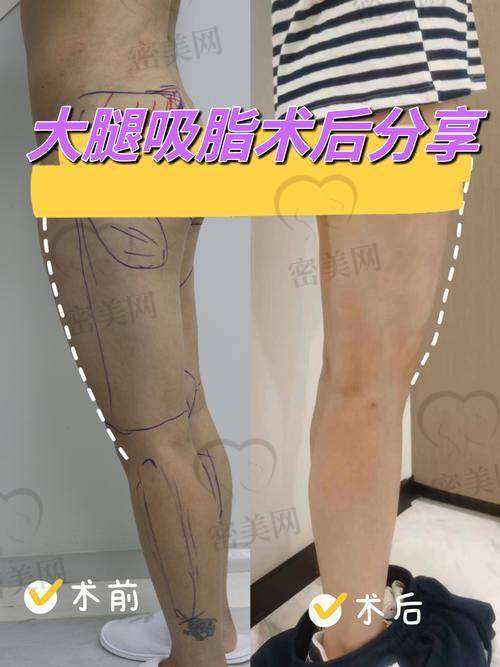 手术进行时：紧张又安心