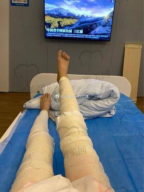 术后修复：惊喜不断
