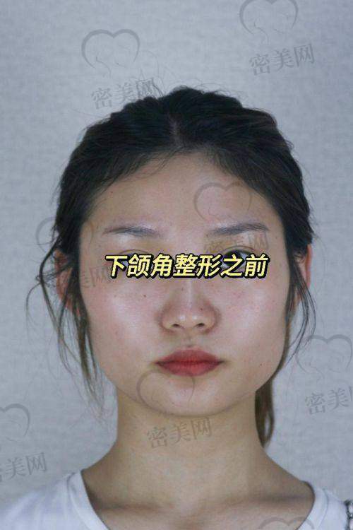 北京华韩整形医院上官文松：实力医生的魅力风采