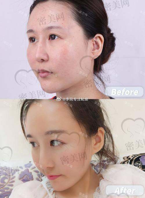 上海华美李志海还擅长哪些手术项目？高能“选手”上线！