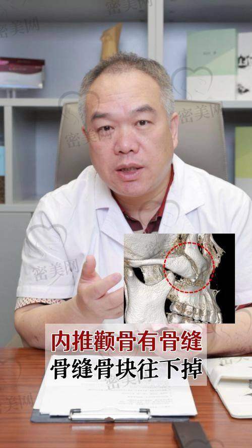 上官文松：颧骨内推界的“魔法大师”