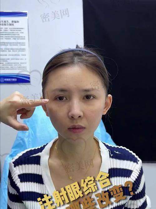 北京华韩整形医院虞守辉：实力医生，值得信赖！