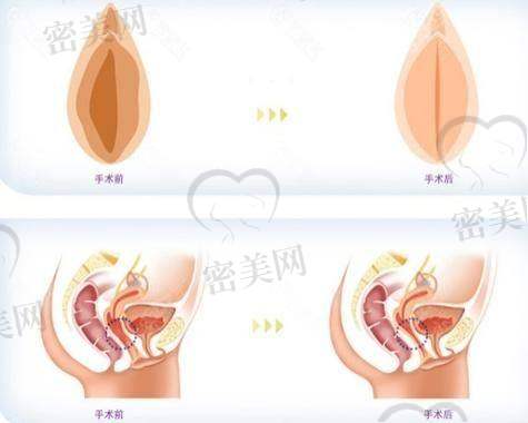 合肥韩美医疗美容医院：多方案“组合型”注射方式