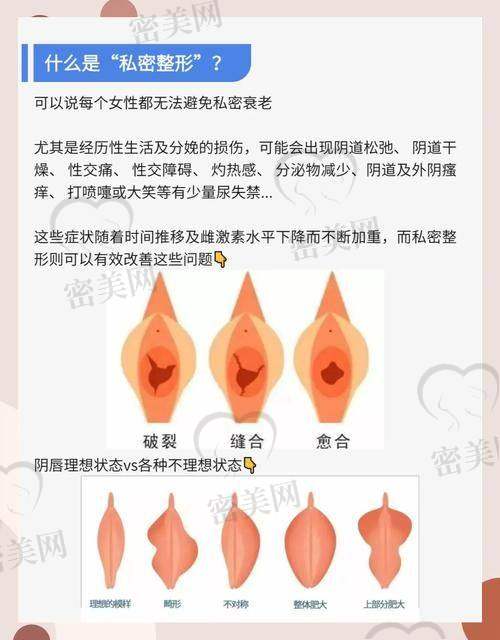 合肥维多利亚医学美容医院：注重成果与美观的统一