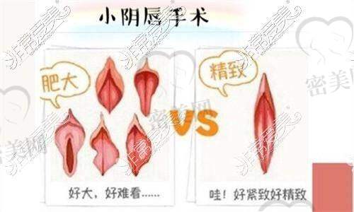 合肥伊美辰医疗美容医院：以自然紧致成效著称