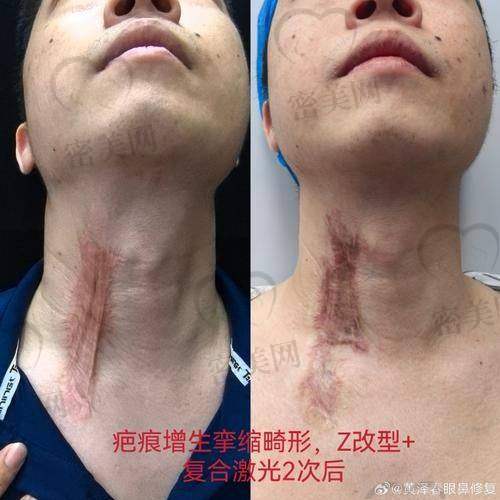 上海艺星医疗美容医院