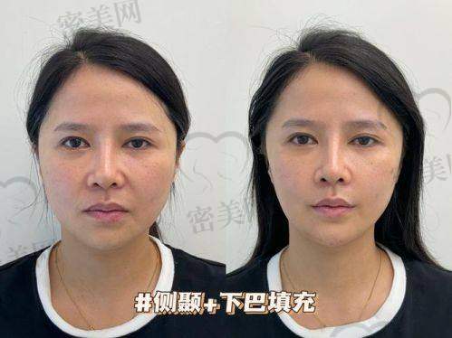 医院和医生的选择