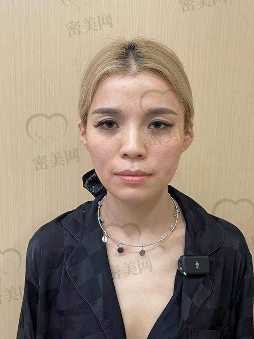 常见填充项目及价格