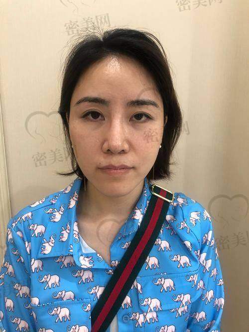 面诊王东医生，感觉超奈斯