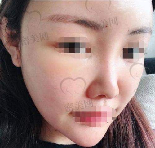 术后成效惊艳，我美出新高度