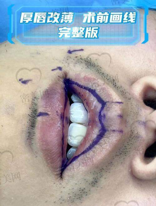 石家庄星源美天医疗美容医院
