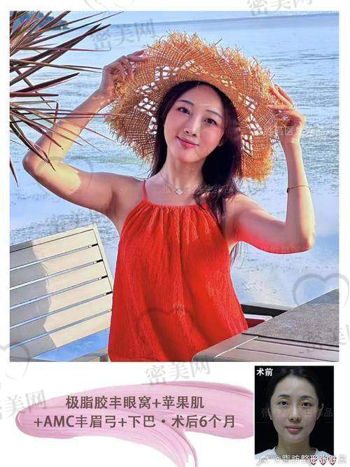 眼窝填充的风险与注意事项