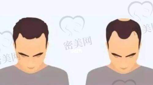 毕珍医生擅长项目：