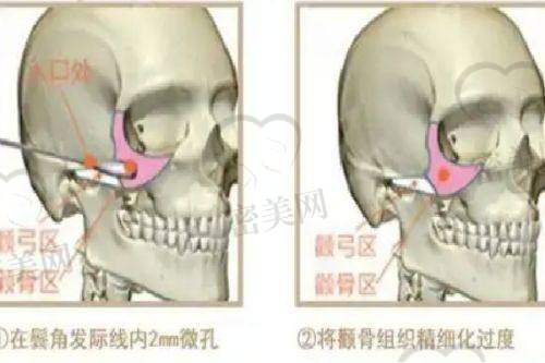 医生技术实力展现