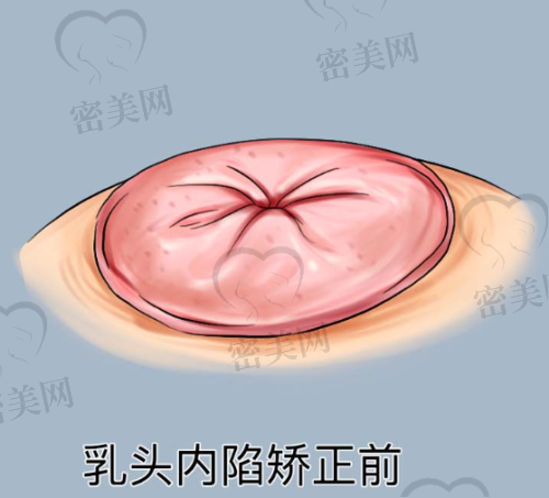 热门项目介绍