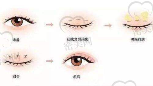 手术详细信息一览（含价格）