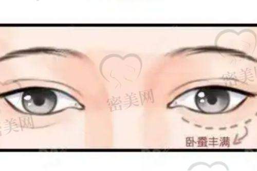 桑建波医生技术特点：