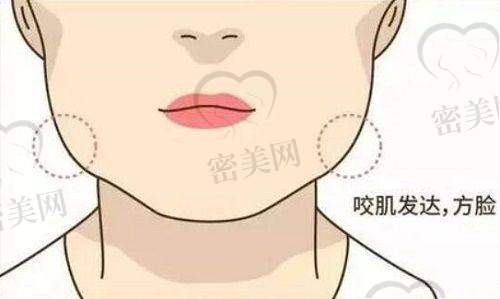 雷建波无痕筋膜提升手术