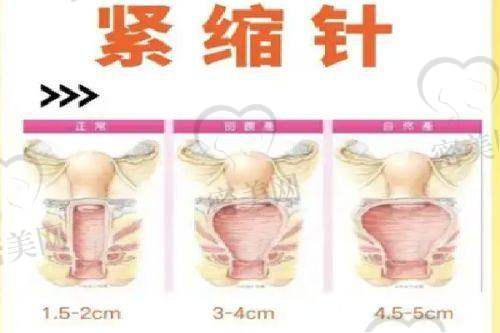 成都欧诺森医疗美容门诊部的考察方向