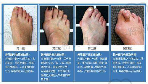 姚玉舒医生擅长项目：