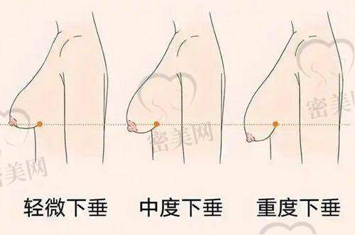 擅长项目