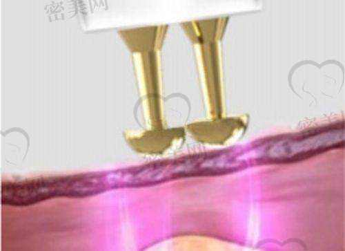 亓发芝医生怎么预约挂号？