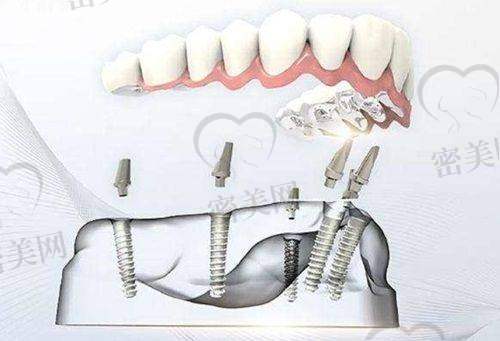 上海王德康口腔诊所怎么预约挂号？