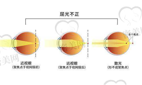 新疆空军 医院眼科医生团队怎么样？