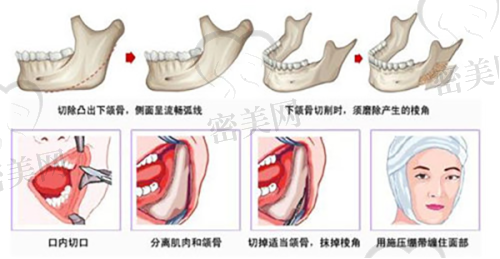 上海虹桥医院|日间手术、家属陪护、术后回访，这些贴心服务都是真实存在