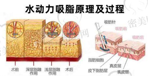 冀宇医生的技术特点：