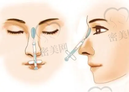 低价不降质的保护措施