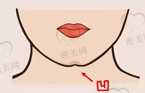 成都割双眼皮相关医院