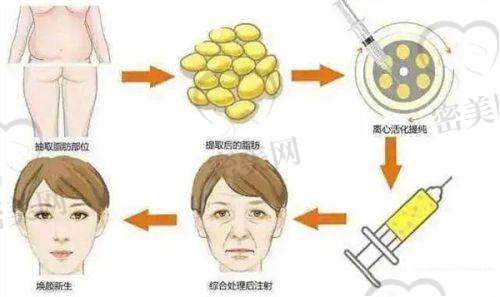 正规医院的优势