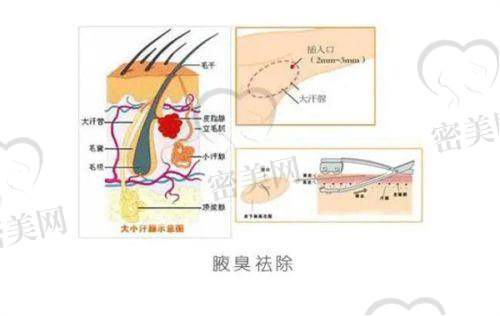 北京润美玉之光医疗美容：纳米脂肪填充+抗衰组合打天下